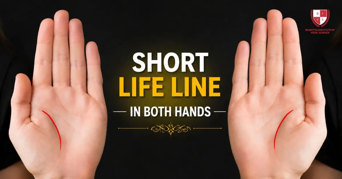Short Life Line in Both Hands